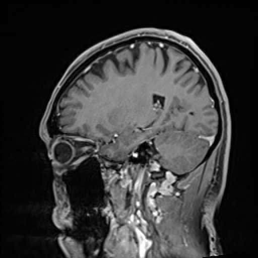 Click on the Serie image to view the images of VILLANUEVA, WILLIAM A.